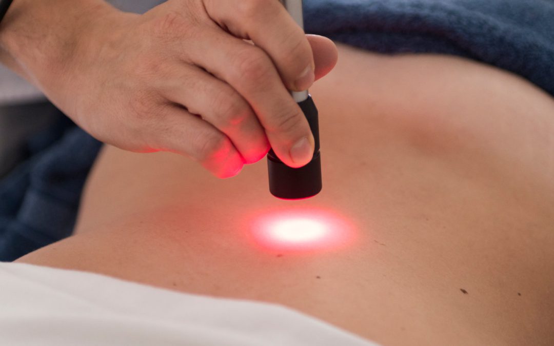 Laserterapia